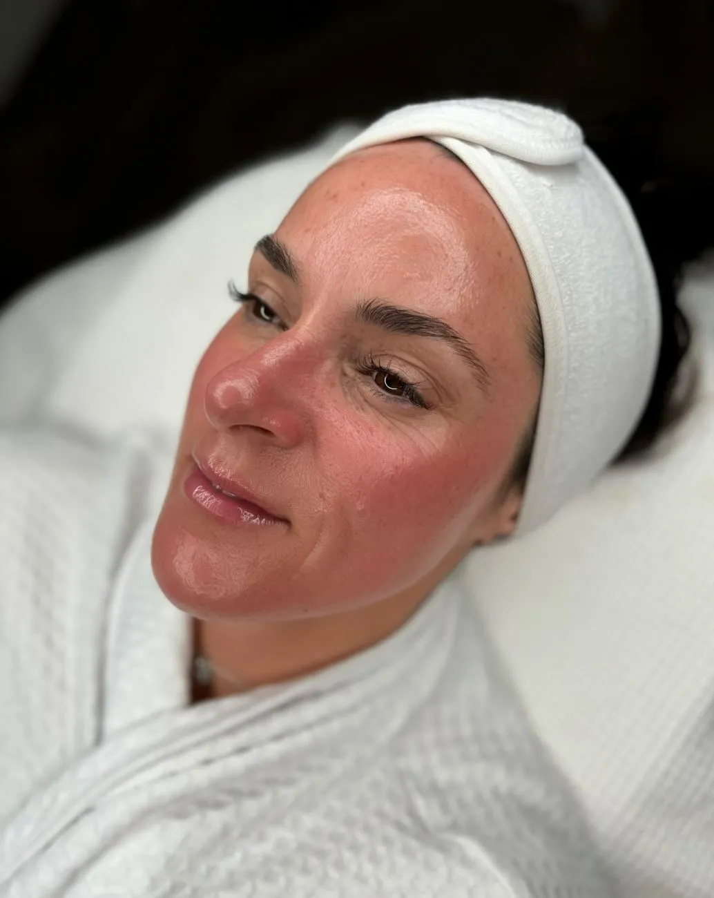 Brisbane skin, Why your postcode matters