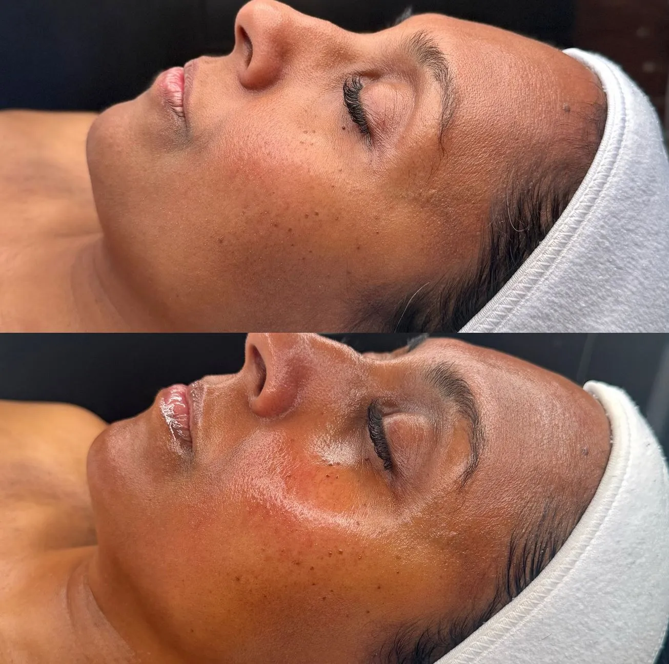 facials near me